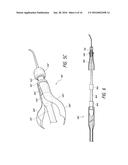 LUMINAL STENTING diagram and image