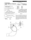 METHOD AND INSTRUMENT FOR TREATING OBESITY diagram and image