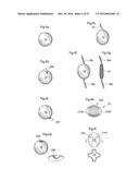 METHOD AND INSTRUMENT FOR TREATING OBESITY diagram and image