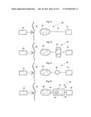 METHOD AND INSTRUMENT FOR TREATING OBESITY diagram and image