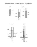 METHOD AND INSTRUMENT FOR TREATING OBESITY diagram and image