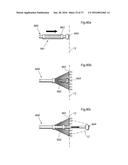 METHOD AND INSTRUMENT FOR TREATING OBESITY diagram and image