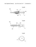 METHOD AND INSTRUMENT FOR TREATING OBESITY diagram and image