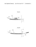 METHOD AND INSTRUMENT FOR TREATING OBESITY diagram and image