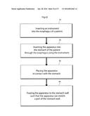 METHOD AND INSTRUMENT FOR TREATING OBESITY diagram and image