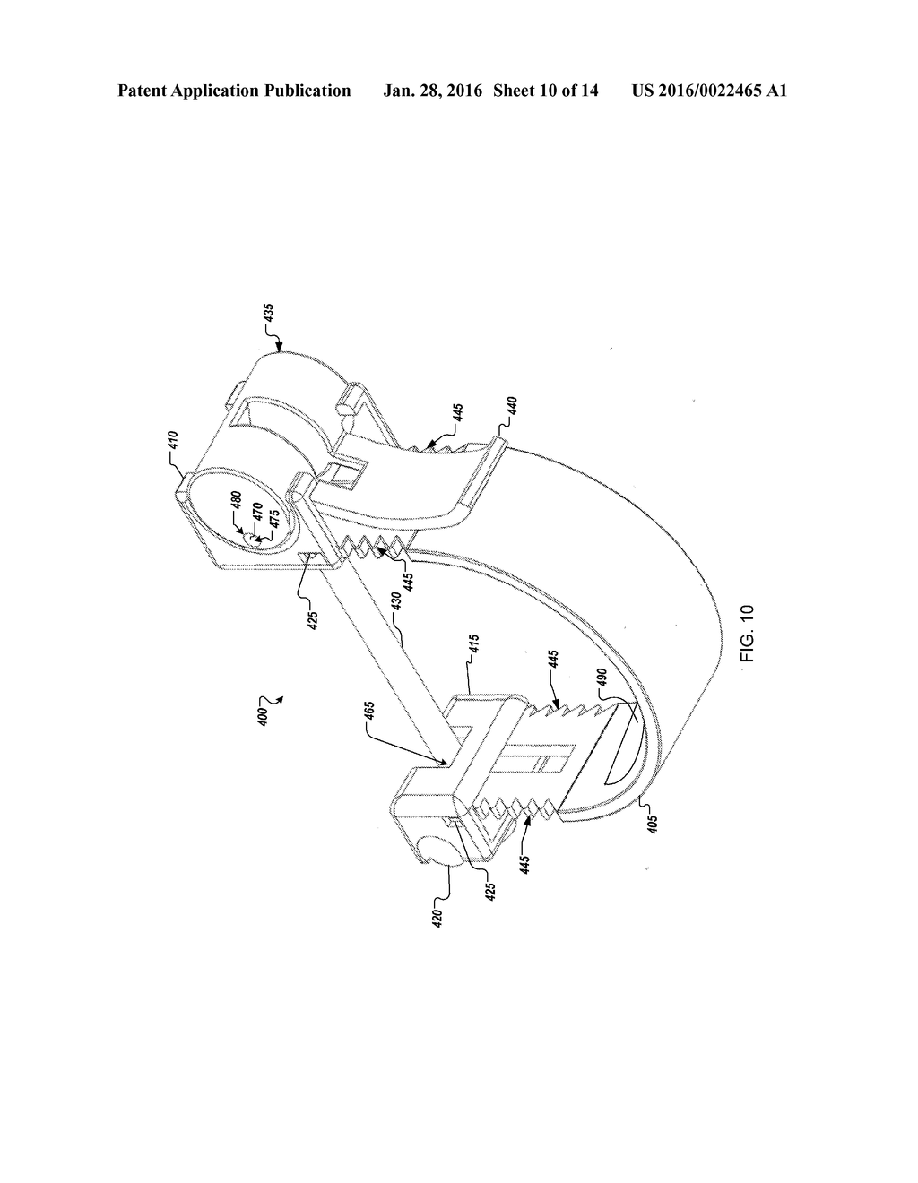 DEVICE FOR APPLYING PRESSURE TO BONES OF ARM AND METHOD OF TREATMENT - diagram, schematic, and image 11