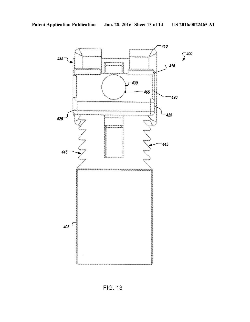 DEVICE FOR APPLYING PRESSURE TO BONES OF ARM AND METHOD OF TREATMENT - diagram, schematic, and image 14