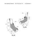 SEQUENTIAL SERIES OF ORTHOPEDIC DEVICES THAT INCLUDE INCREMENTAL CHANGES     IN FORM diagram and image