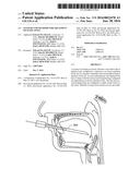 SYSTEMS AND METHODS FOR TREATMENT OF SLEEP APNEA diagram and image