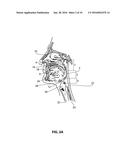 SYSTEMS AND METHODS FOR TREATMENT OF SLEEP APNEA diagram and image