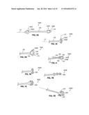 SYSTEMS AND METHODS FOR TREATMENT OF SLEEP APNEA diagram and image