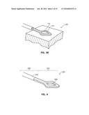 SYSTEMS AND METHODS FOR TREATMENT OF SLEEP APNEA diagram and image