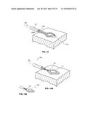 SYSTEMS AND METHODS FOR TREATMENT OF SLEEP APNEA diagram and image