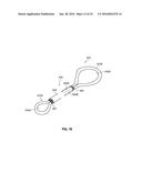 SYSTEMS AND METHODS FOR TREATMENT OF SLEEP APNEA diagram and image