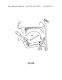 SYSTEMS AND METHODS FOR TREATMENT OF SLEEP APNEA diagram and image