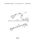 SYSTEMS AND METHODS FOR TREATMENT OF SLEEP APNEA diagram and image