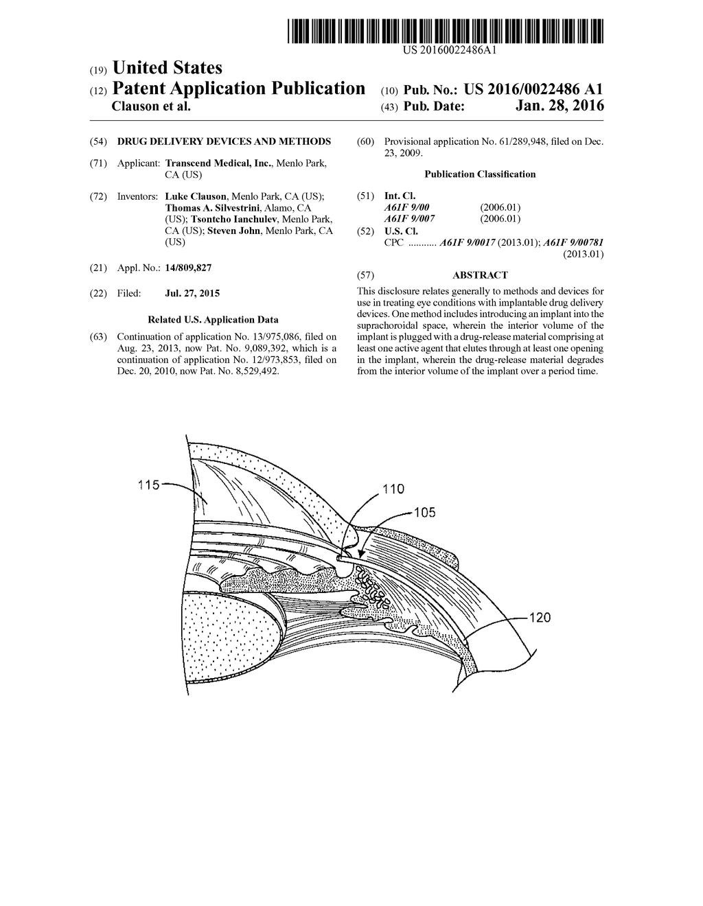 Drug Delivery Devices And Methods - diagram, schematic, and image 01