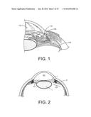 Drug Delivery Devices And Methods diagram and image