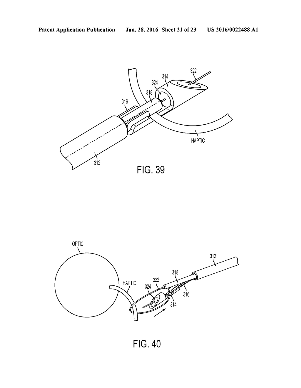 INTRAOCULAR LENS FIXATION CORRECTION METHODS AND DEVICES - diagram, schematic, and image 22