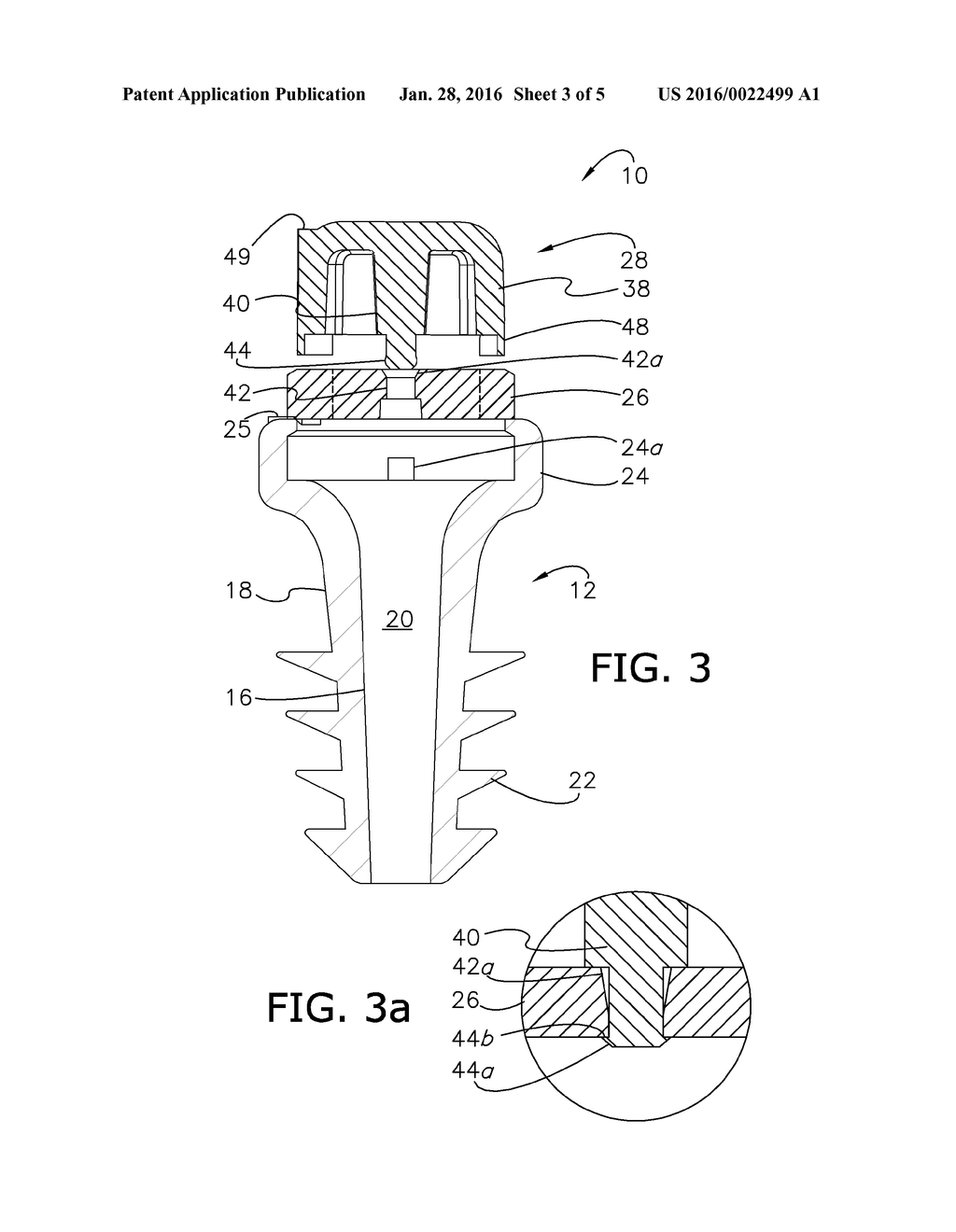 ADJUSTABLY ATTENUATING EAR PLUG - diagram, schematic, and image 04