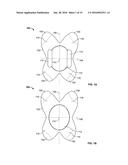 DEVICES AND METHODS FOR TREATING ACCIDENTAL BOWEL LEAKAGE diagram and image