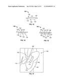 DEVICES AND METHODS FOR TREATING ACCIDENTAL BOWEL LEAKAGE diagram and image