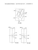 DEVICES AND METHODS FOR TREATING ACCIDENTAL BOWEL LEAKAGE diagram and image