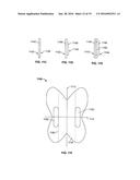 DEVICES AND METHODS FOR TREATING ACCIDENTAL BOWEL LEAKAGE diagram and image