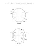 DEVICES AND METHODS FOR TREATING ACCIDENTAL BOWEL LEAKAGE diagram and image