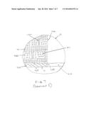 MEDICAL IMPLANT diagram and image