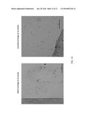 Minced Cartilage Systems and Methods diagram and image