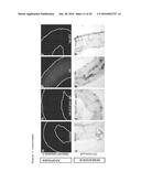 THERAPEUTIC METHODS FOR TREATING SOLID TUMORS AND RELATED DIAGNOSTIC     METHODS diagram and image