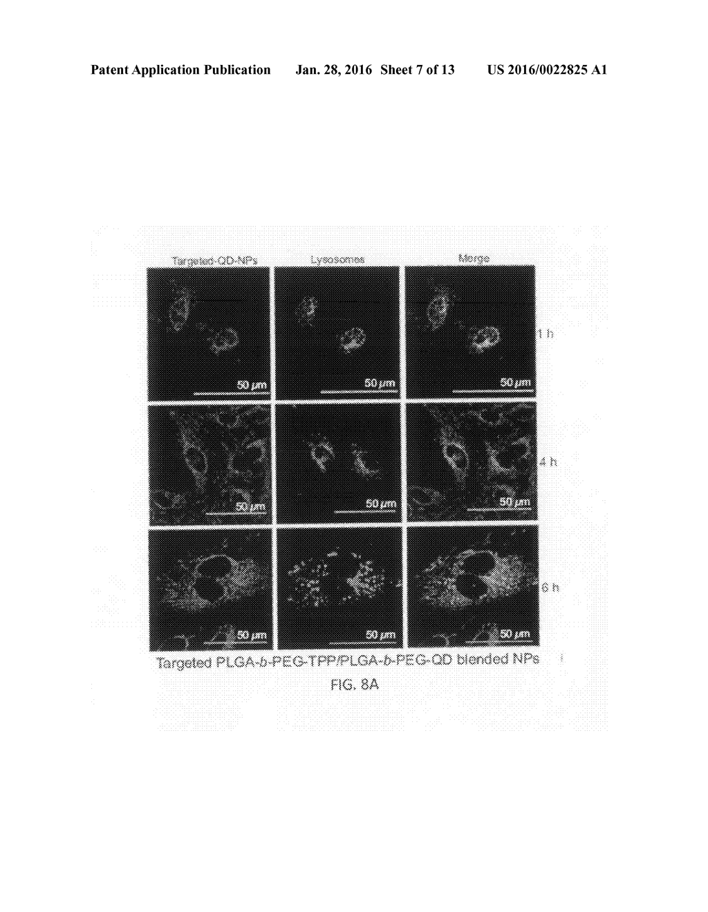 NANOPARTICLES FOR MITOCHONDRIAL TRAFFICKING OF AGENTS - diagram, schematic, and image 08