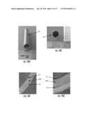 MEDICAL CONSTRUCTS INCLUDING TUBES AND COLLAGEN FIBERS diagram and image