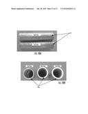 MEDICAL CONSTRUCTS INCLUDING TUBES AND COLLAGEN FIBERS diagram and image