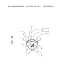 RENAL PUMP diagram and image