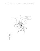 RENAL PUMP diagram and image