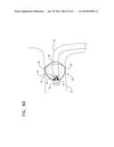 RENAL PUMP diagram and image