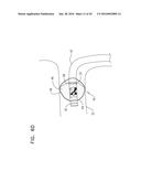 RENAL PUMP diagram and image