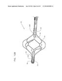 RENAL PUMP diagram and image