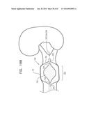 RENAL PUMP diagram and image