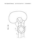 RENAL PUMP diagram and image