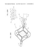 RENAL PUMP diagram and image