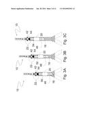 METHOD AND APPARATUS FOR DETERMINING OPTIMAL ENDOTRACHEAL TUBE SIZE diagram and image