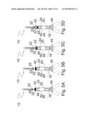 METHOD AND APPARATUS FOR DETERMINING OPTIMAL ENDOTRACHEAL TUBE SIZE diagram and image