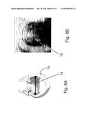 METHOD AND APPARATUS FOR DETERMINING OPTIMAL ENDOTRACHEAL TUBE SIZE diagram and image