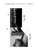 METHOD AND APPARATUS FOR DETERMINING OPTIMAL ENDOTRACHEAL TUBE SIZE diagram and image