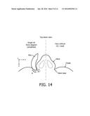 SUBNASAL SEALING CUSHION AND PATIENT INTERFACE DEVICE EMPLOYING SAME diagram and image