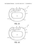 SUBNASAL SEALING CUSHION AND PATIENT INTERFACE DEVICE EMPLOYING SAME diagram and image