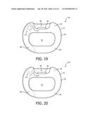 SUBNASAL SEALING CUSHION AND PATIENT INTERFACE DEVICE EMPLOYING SAME diagram and image